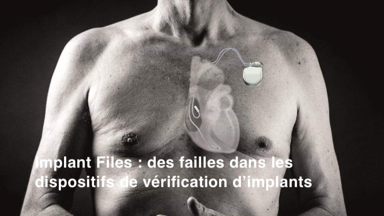 Loi. Implant Files : des failles dans les dispositifs de certification